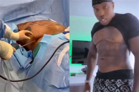 Bandman Kevo Gets Liposuction for His Abs